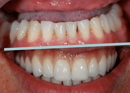 Caso realizado pela Dra. Adriana Lànger