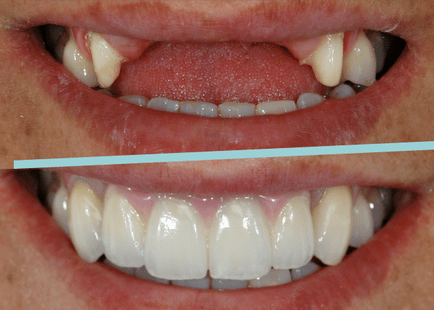 Caso realizado pele Dra. Adriana Lànger